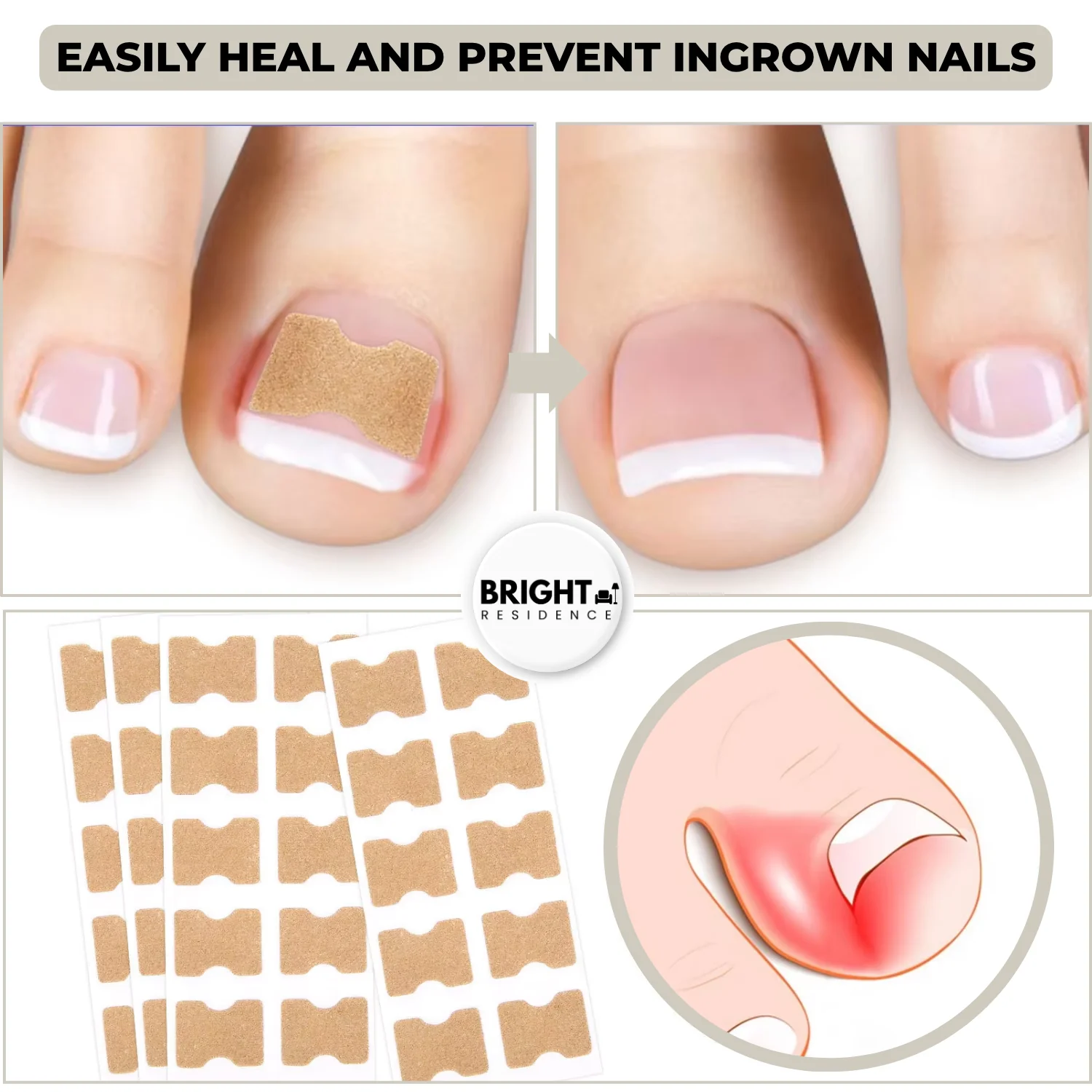 FixaNail™ - Correction Patches for Beautiful and Healthy Nails - Image 3