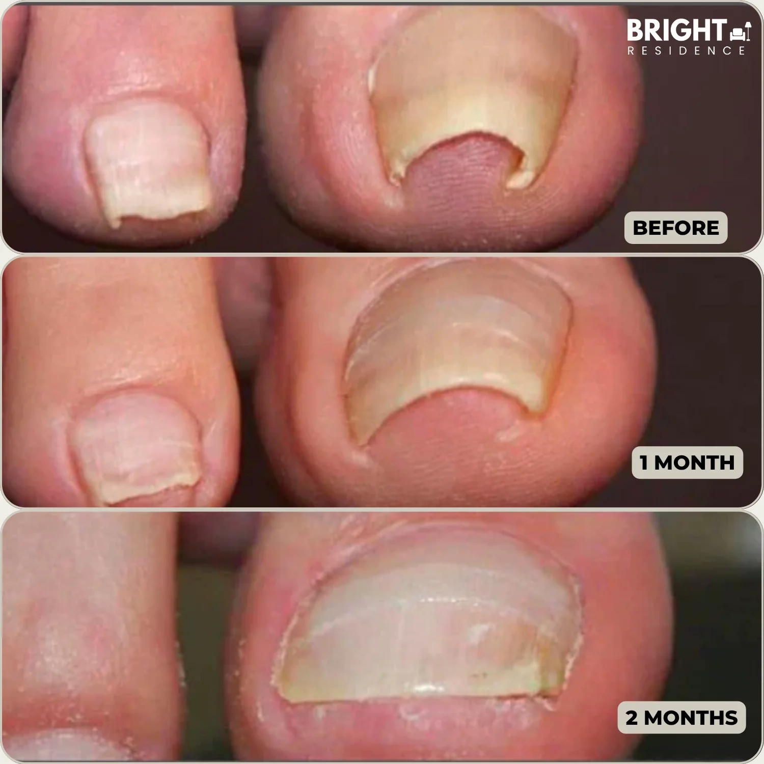 FixaNail™ - Correction Patches for Beautiful and Healthy Nails - Image 4