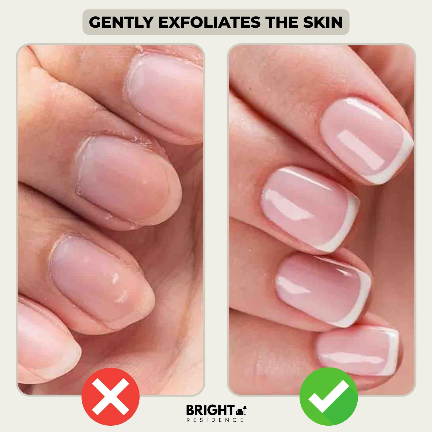 1+1 FREE | GlossBloom – Healthy Nails in an Instant! - Image 3